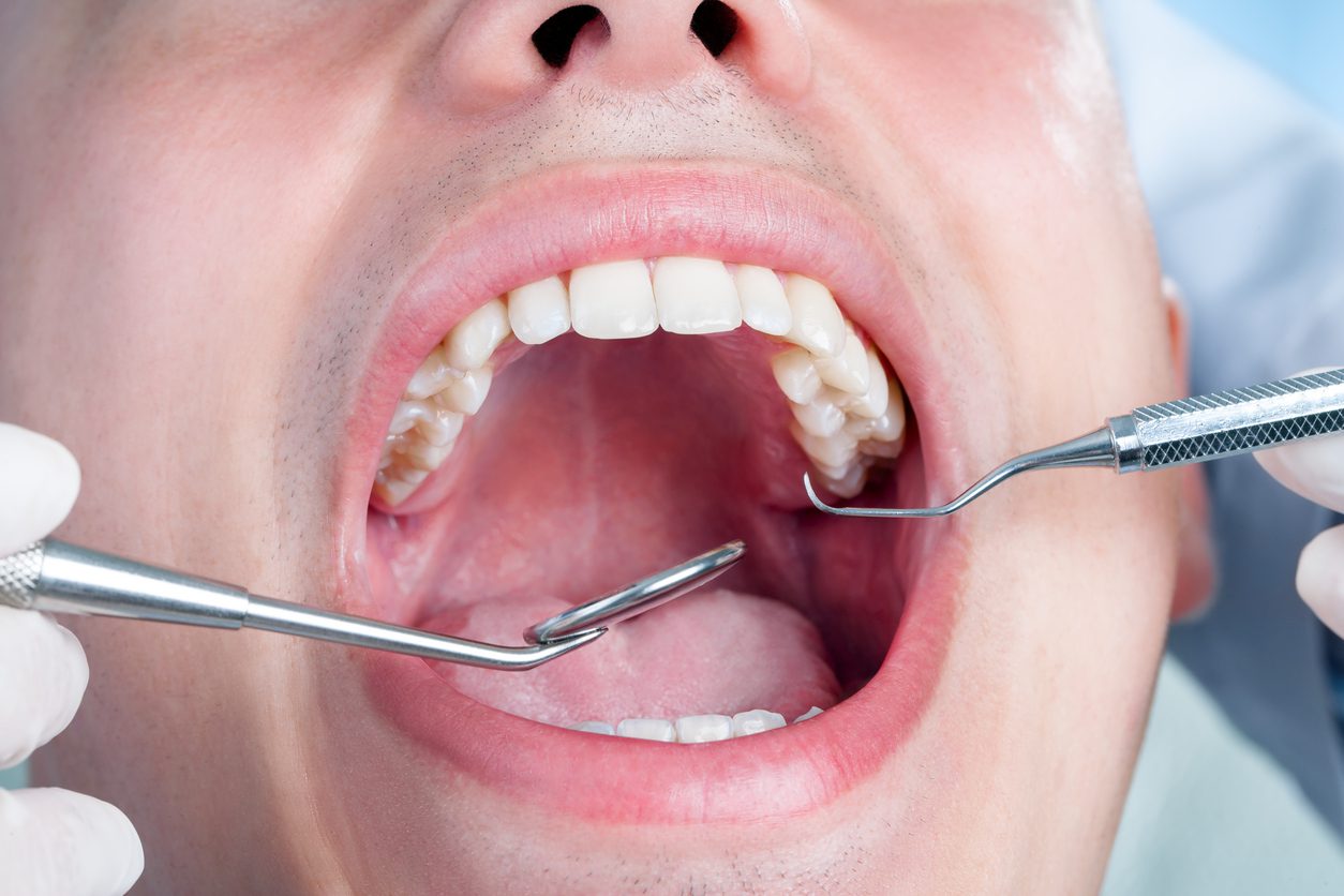 https://dentistryatwaterview.com/wp-content/uploads/2021/06/root-canal.jpg
