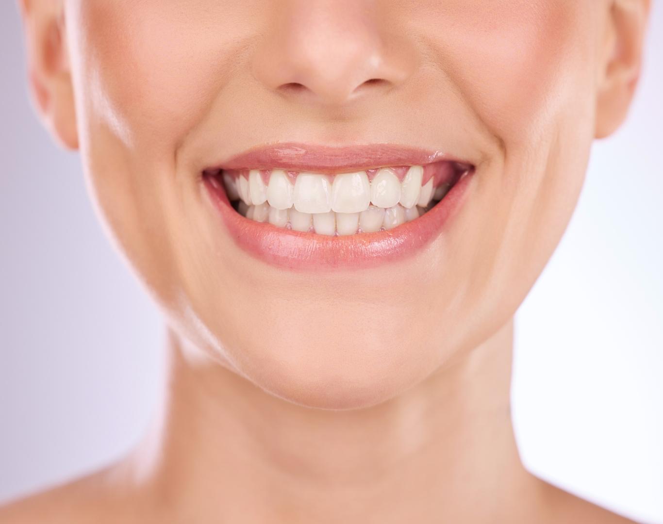 Teeth whitening in Stoney Creek, ON at Dentistry at Waterview