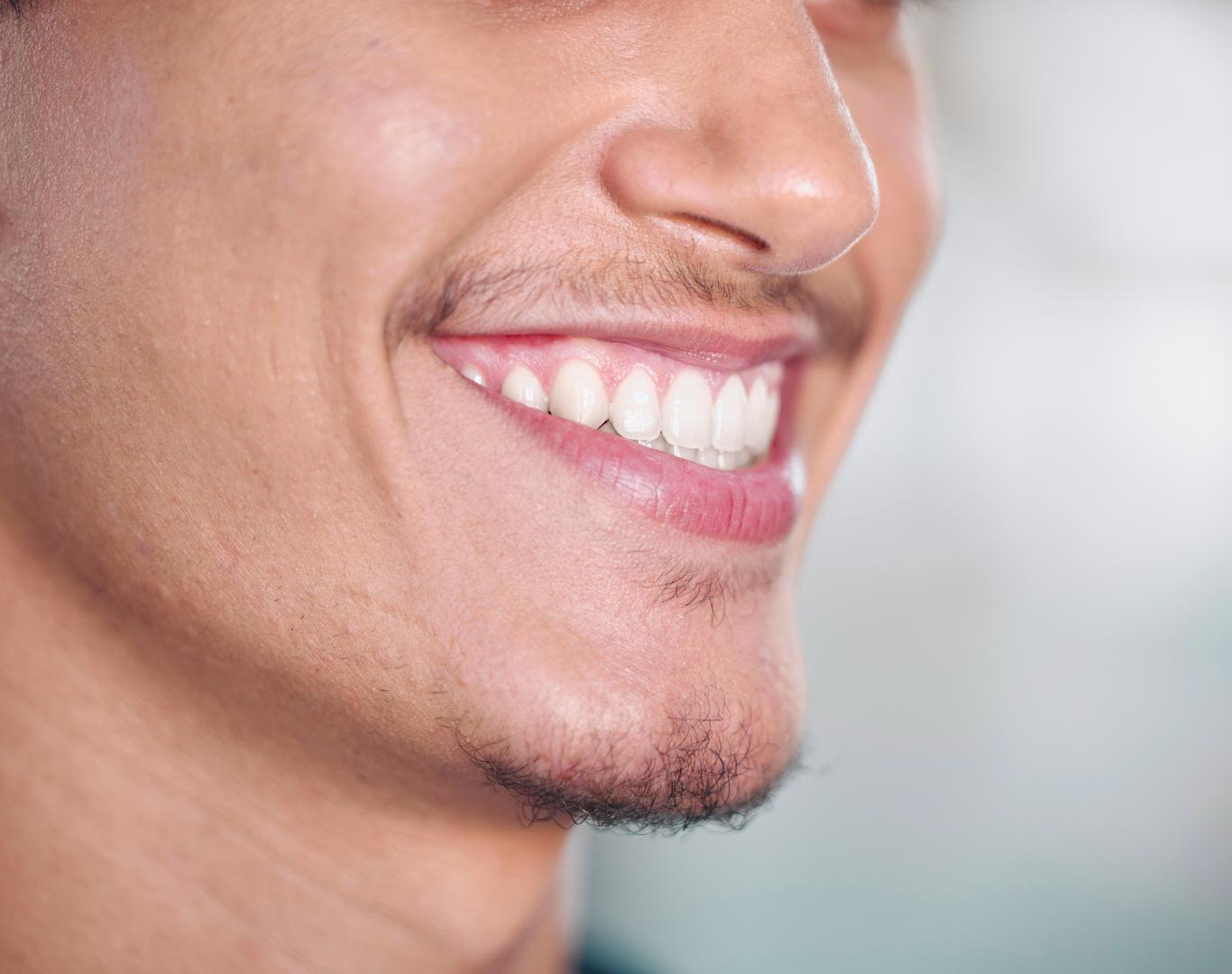 Patient smiling after taking cosmetic dentist in Stoney Creek, ON