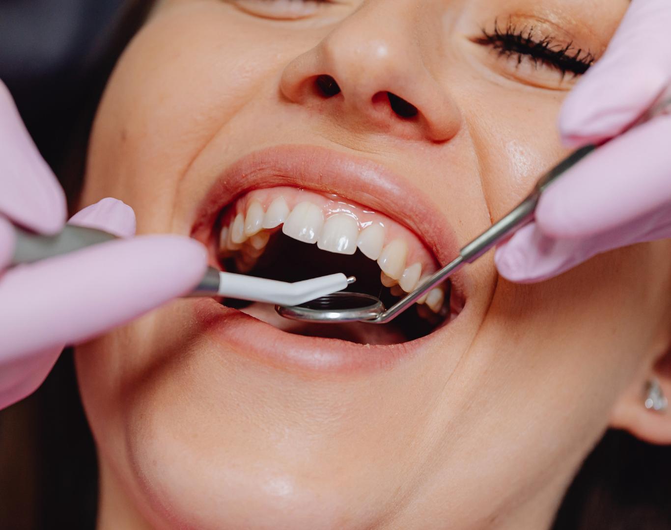 Permanent full arch implants near me in Smithville, ON with expert care