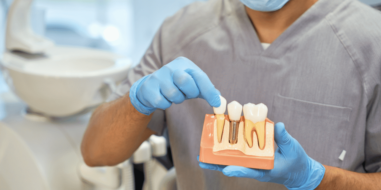 Your Complete Guide to Finding the Best Dental Implants in Beamsville, Ontario