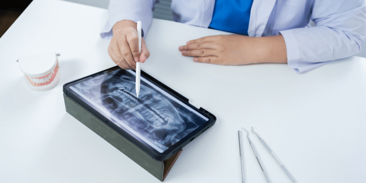 Your Complete Guide to Finding the Best Dental Implants in Stoney Creek, Ontario