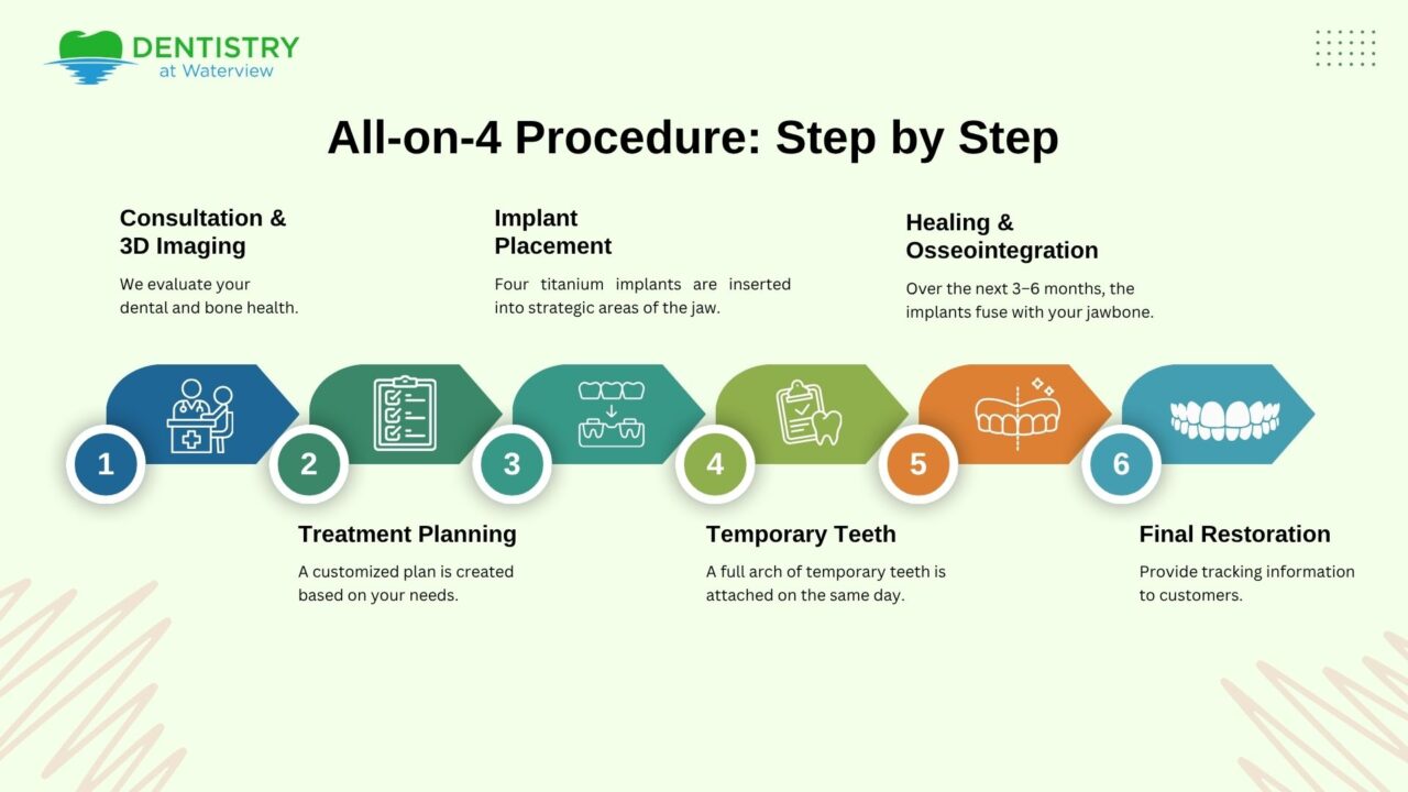 All-on-4 Procedure: Step by Step