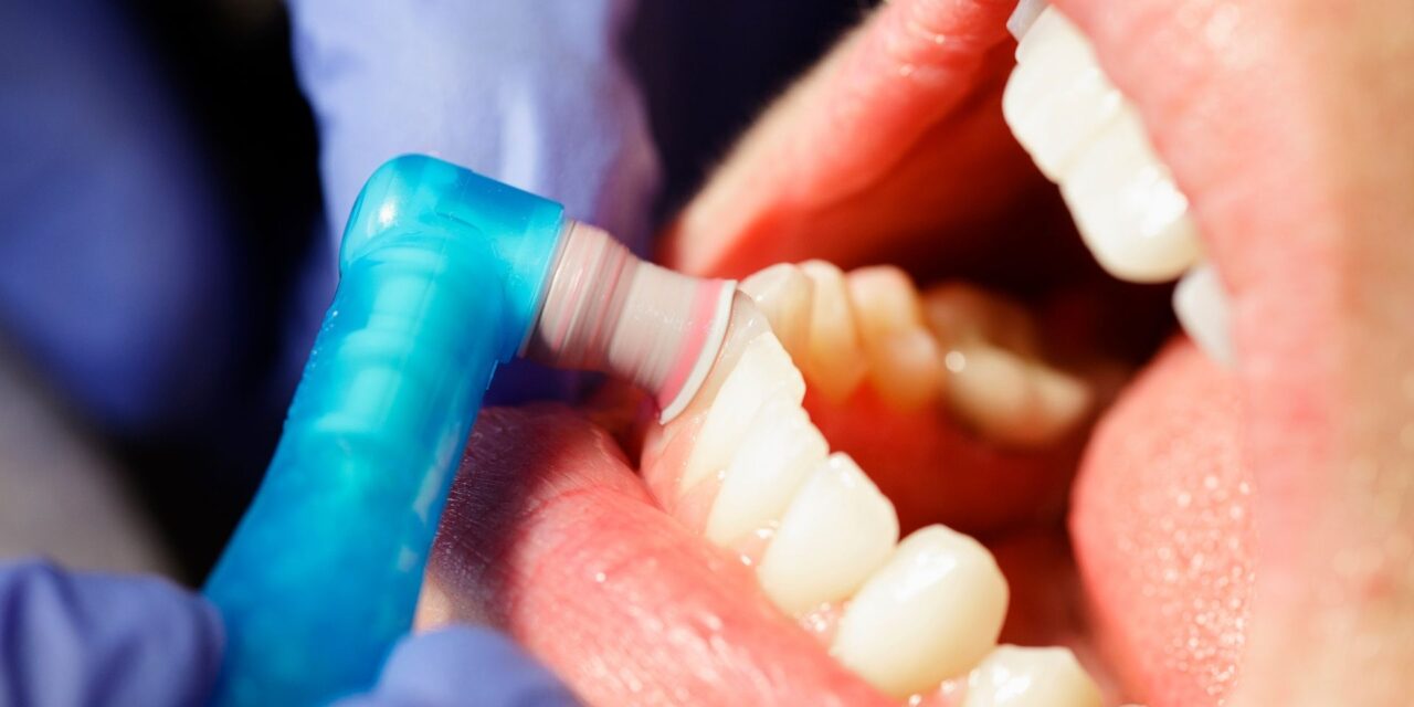 Top-Rated Dental Cleaning in Smithville: Safe, Thorough & Affordable